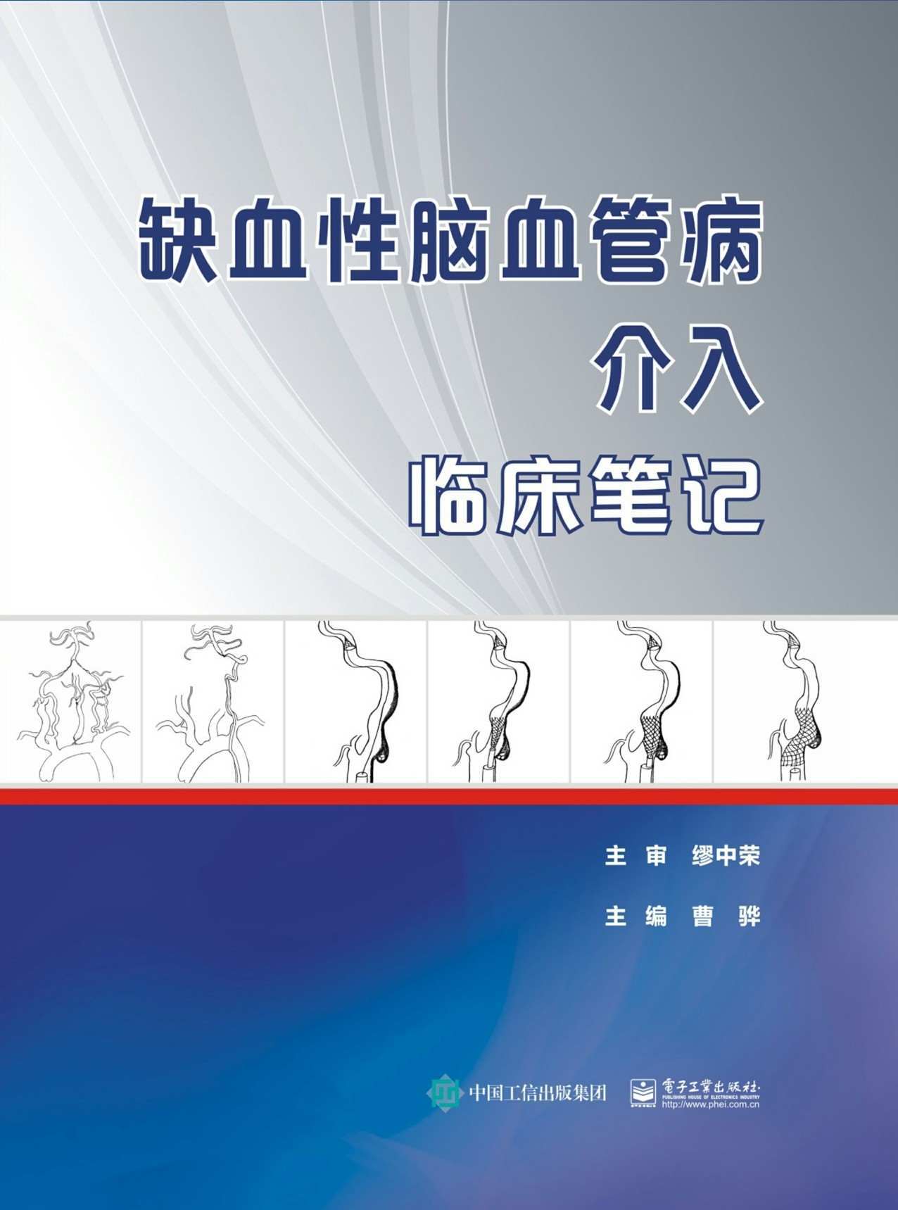 缺血性脑血管病介入临床笔记